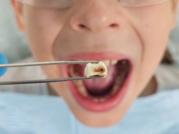 Best Emergency Dental Care for Broken or Chipped Teeth in , AK