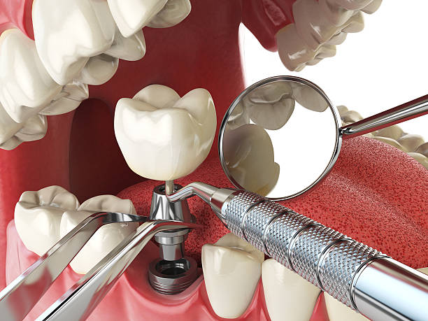 Best Emergency Treatment for Dental Infections or Abscesses in , AK